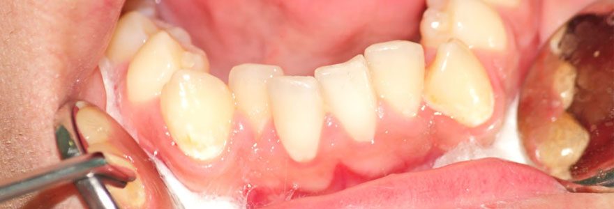 Problèmes de dents : trouver un service d&rsquo;urgence dentaire dans le 92