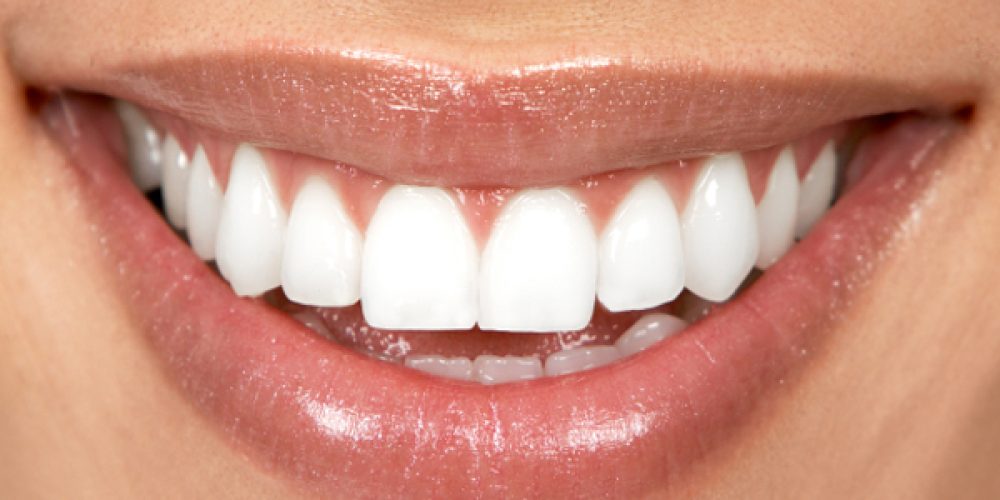 L’implant dentaire, qu’est-ce que c’est ?