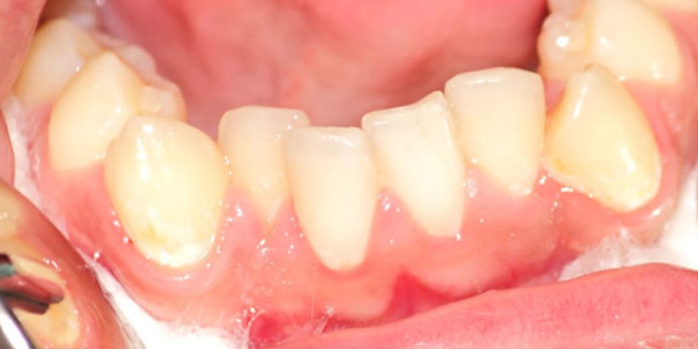 Problèmes de dents : trouver un service d’urgence dentaire dans le 92